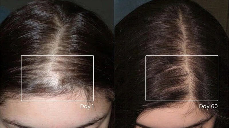 See visible changes with consistent use.